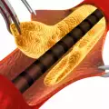 What is Cholesterol?
