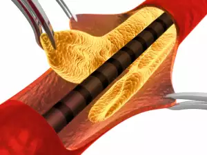 What is Cholesterol?