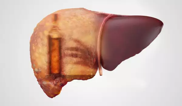 Dangers of alcohol on liver